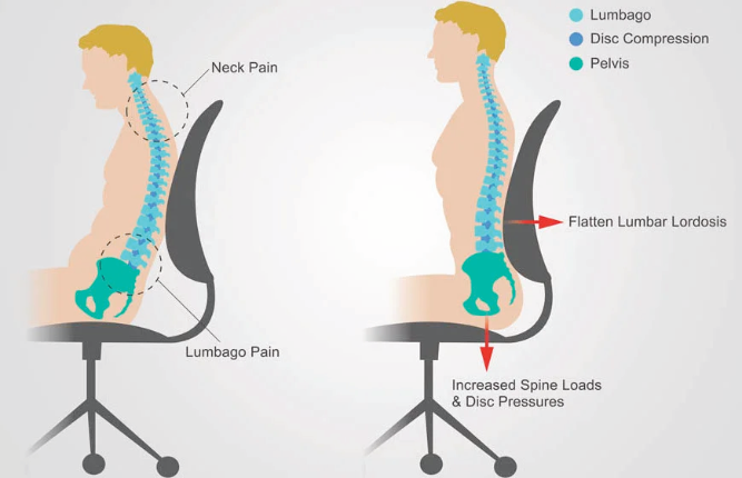 Ergonomics And Posture Care 1