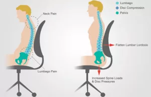 Ergonomics And Posture Care Services Enhancing Comfort, Efficiency, And Well-Being In The Workplace. Addressing Musculoskeletal Issues From Poor Posture And Inadequate Ergonomics. Click Here To Learn More About Our Ergonomics And Posture Care Services. Physiotherapist India