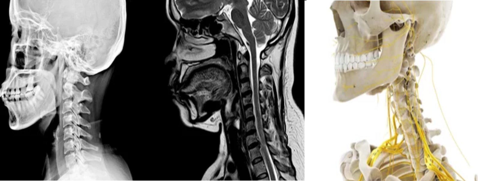 Anatomy Of Cervical Spine