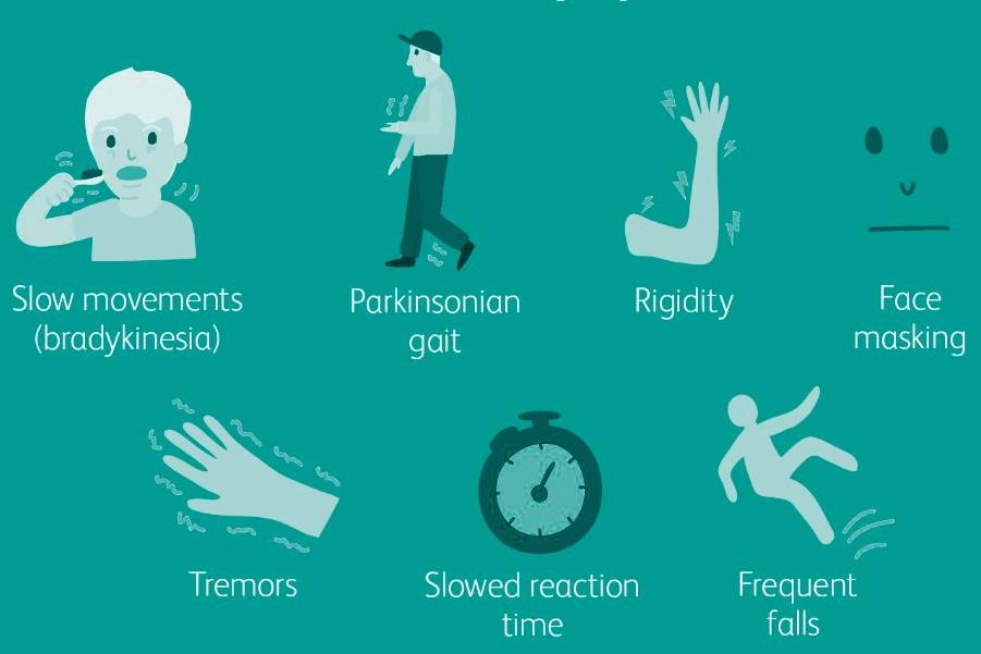 Parkinsons Symptoms