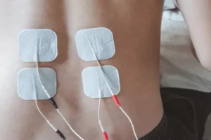 Principles Of Electrotherapy In Physiotherapy