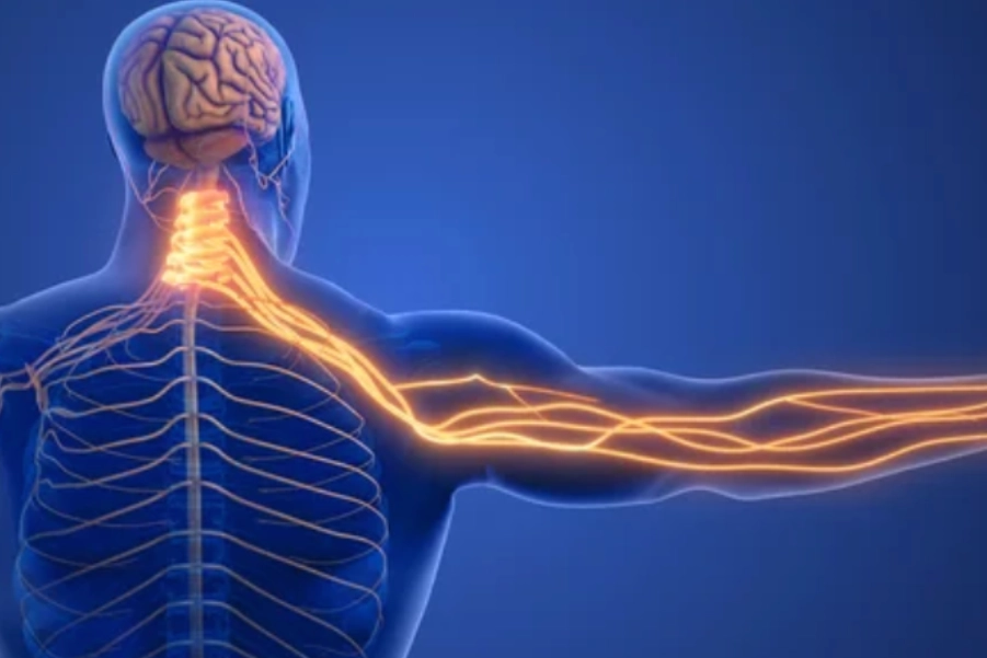 Cervical Radiculopathy With Foraminal Stenosis