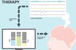 Emg Biofeedback Therapy