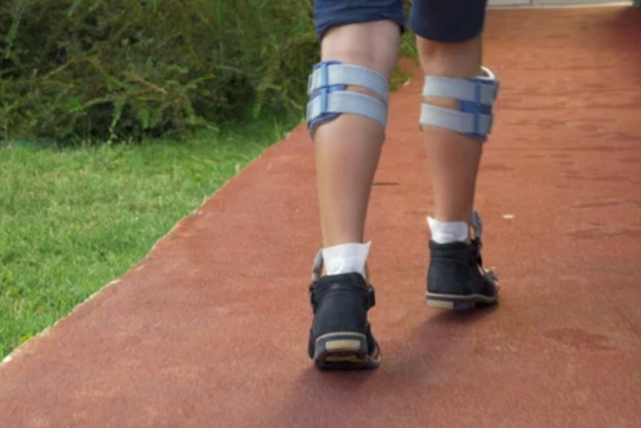 Functional Electrical Stimulation (FES): Applications & Benefits