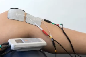 Tens Transcutaneous Electrical Nerve Stimulation