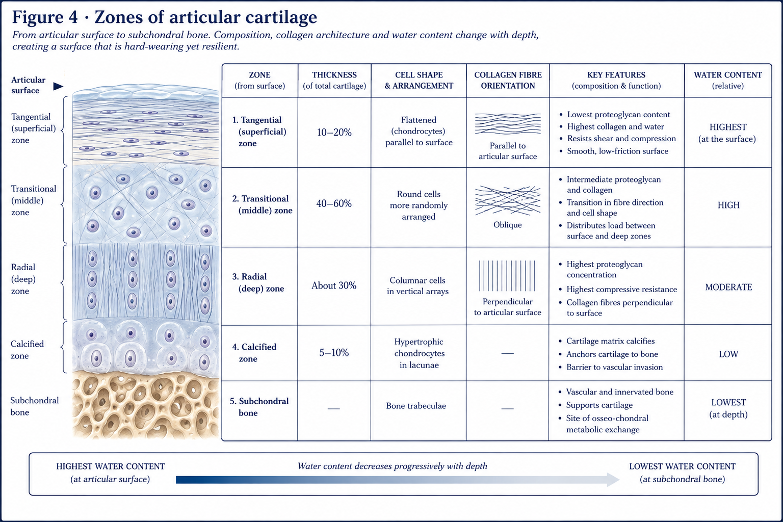 The four zones of articular cartilage from the surface down to bone, each with its share of the total thickness, its cell shape and arrangement, its collagen fibre direction, and its relative water content, ending in the subchondral bone.