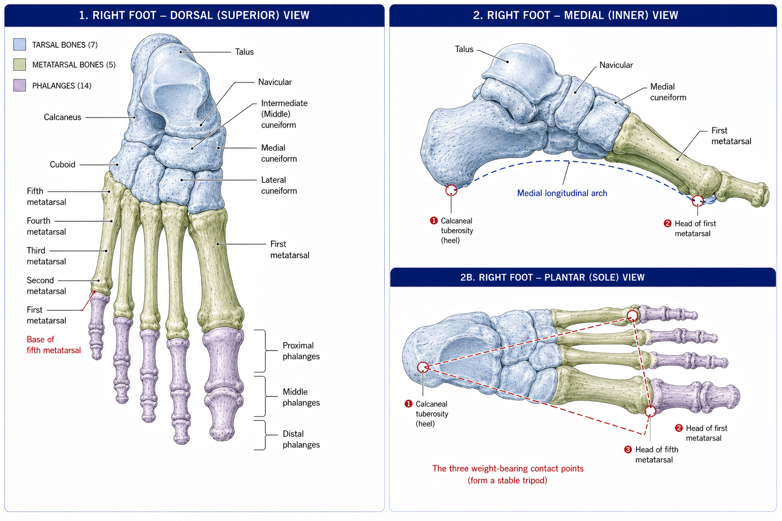 The right foot from above with all twenty-six bones named and the tarsal, metatarsal and phalangeal groups shaded separately, a medial view tracing the longitudinal arch, and a plantar view marking the three weight-bearing contact points as a tripod.