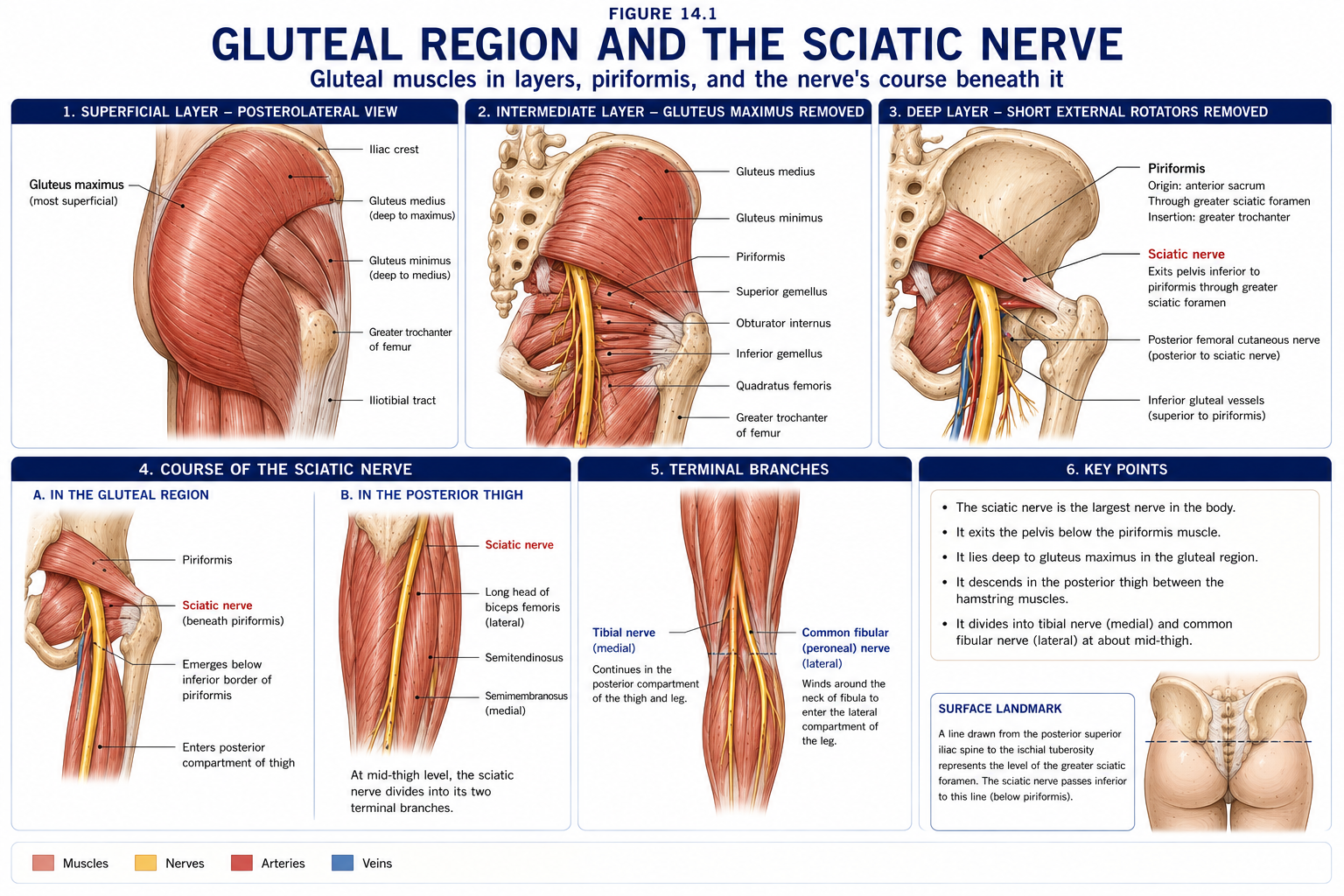 The gluteal region dissected in layers, from gluteus maximus through the deeper gluteal muscles to the short external rotators, with piriformis identified and the sciatic nerve traced from the greater sciatic foramen down through the posterior thigh to its terminal branches.