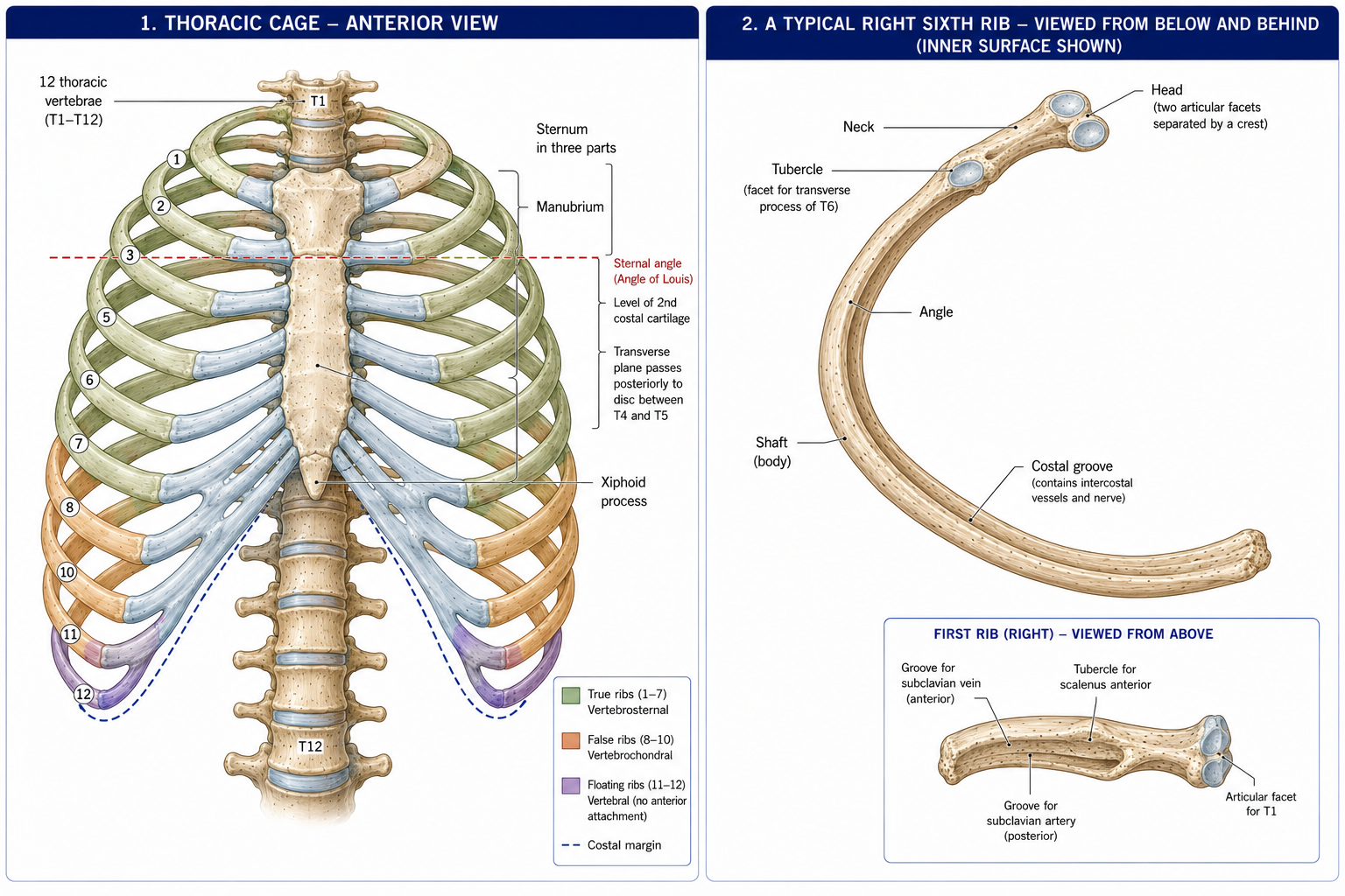 The rib cage from the front with true, false and floating ribs shaded separately and the sternal angle carried back to the disc between the fourth and fifth thoracic vertebrae, beside a typical rib seen from below and behind with its head, neck, tubercle, angle and costal groove, and an inset of the first rib.